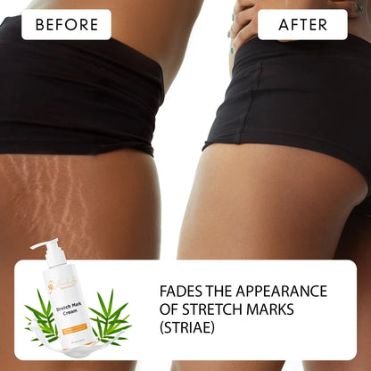 Advanced Stretch Mark Removal Cream