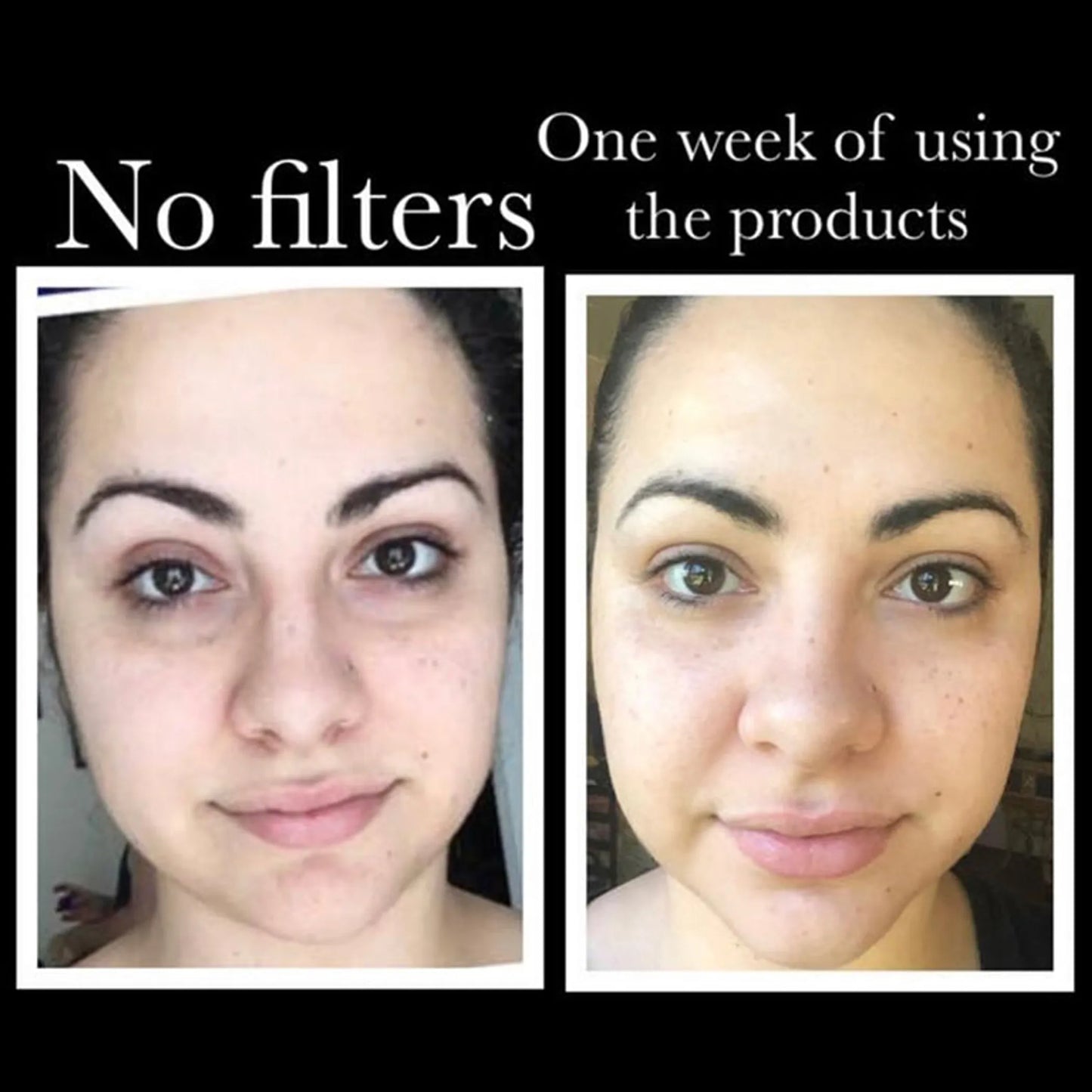 SkinSanity Youth Restore Regimen