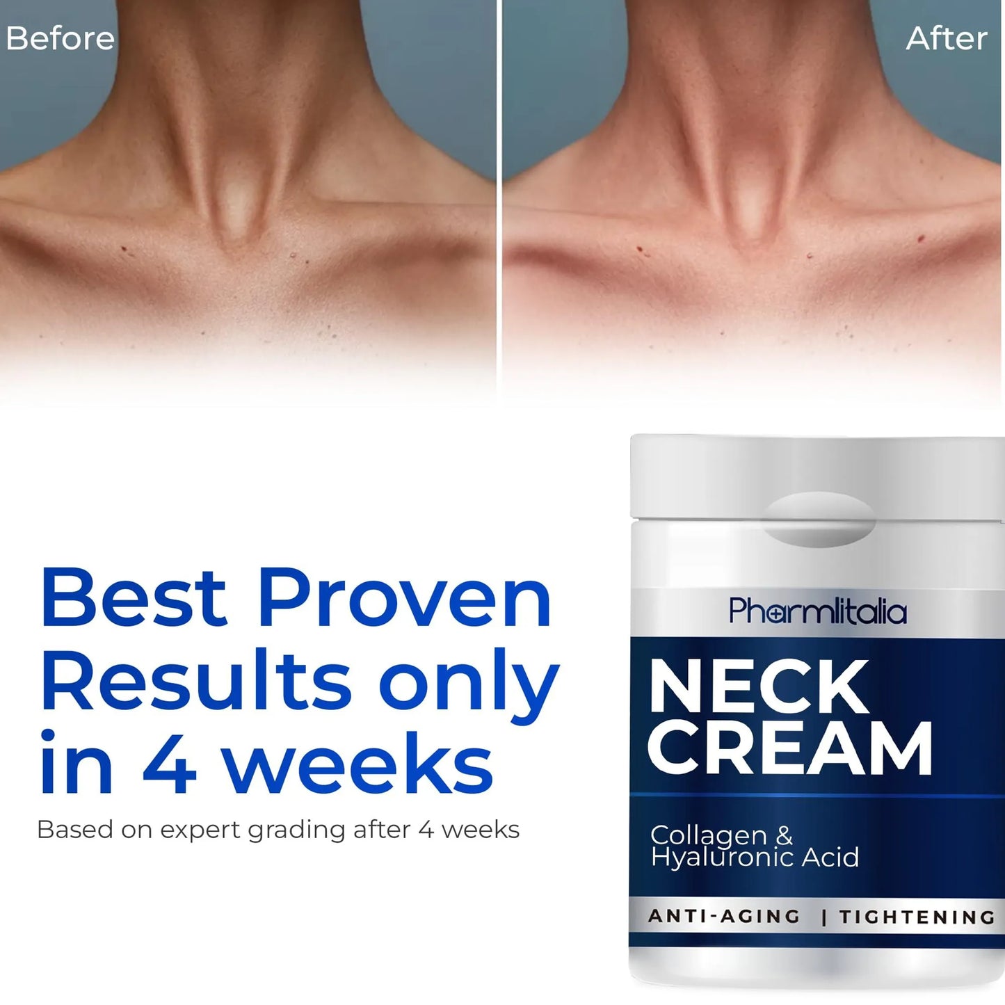 Neck Firming and Tightening Cream