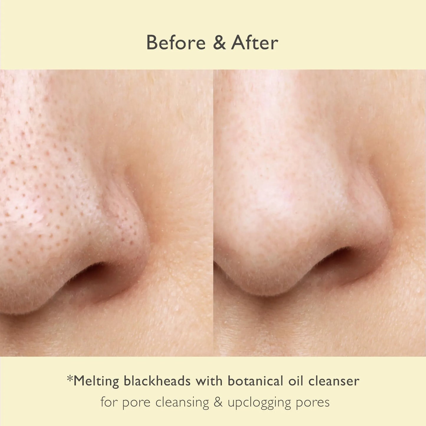 No Pore Cleansing Oil Makeup Cleansing Oil Pore Cleansing Blackheads Removal Olive Oil Tea Tree Squalane Korean Skin Care for face (6.76 fl.oz)