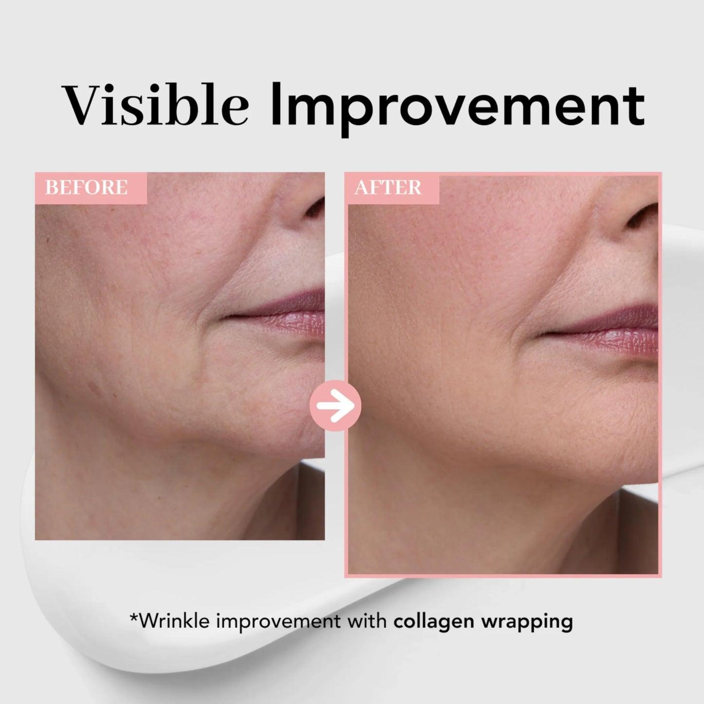 Collagen Wrapping Mask