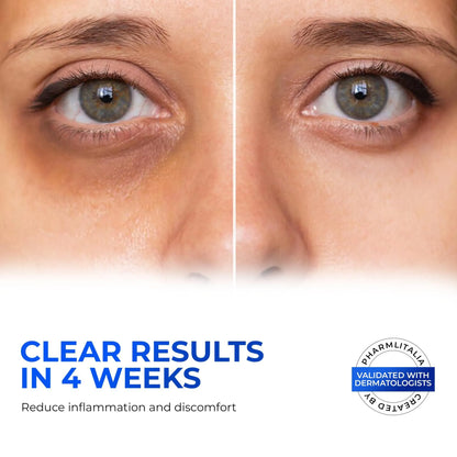 Retinol Eye Cream for Puffiness and Bags Under Eyes