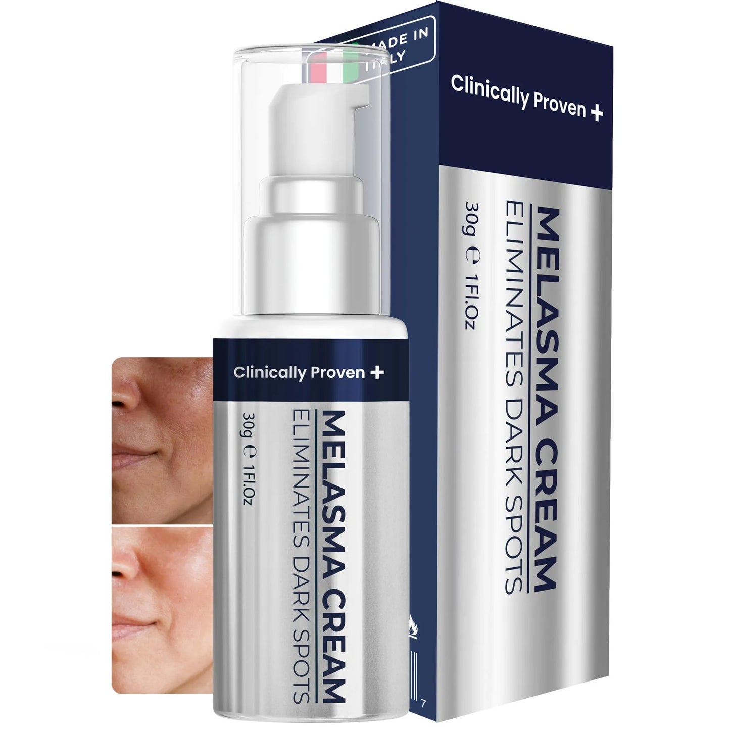 Dark Spot Remover for Face & Body Melasma Cream