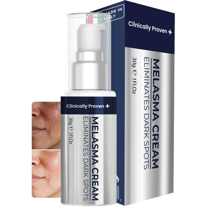 Dark Spot Remover for Face & Body Melasma Cream