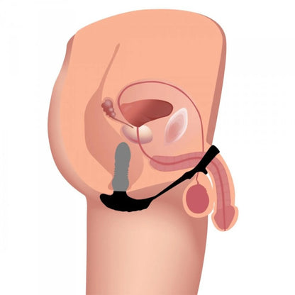 THUNDERPLUGS 10X THRUSTING PLUG W/ COCK & BALL RING